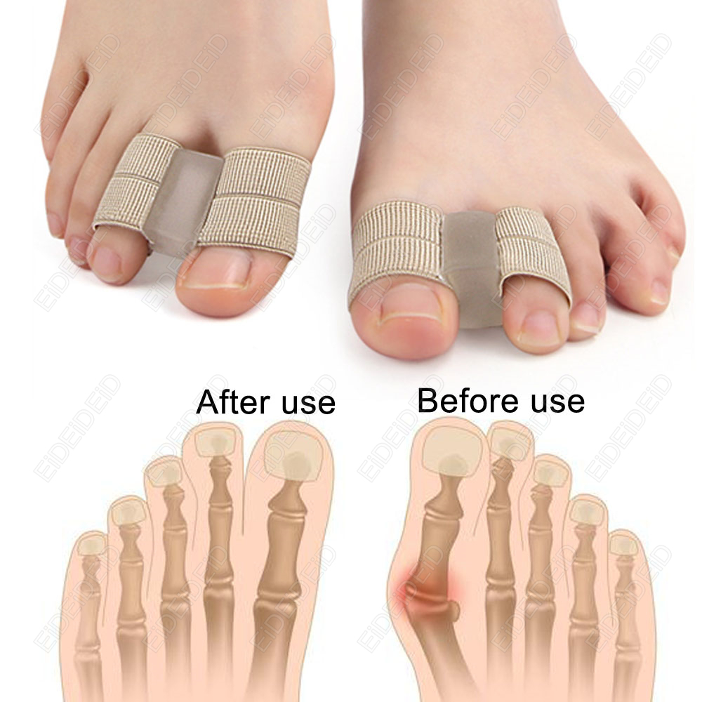 Corretor de joanete ortopédico - Women'S Shoes With Bunions avaliação e preço